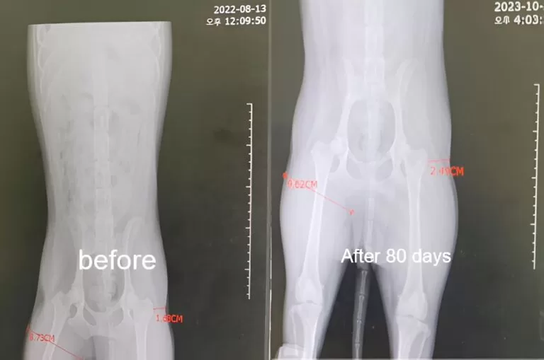 Case 4